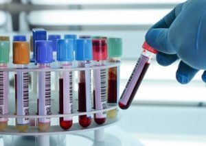 Azərbaycanda hepatitə yoluxanların sayı əhalinin 2%-ni təşkil edir