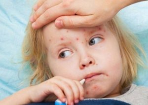 Ölkədə donuz qripi və qızılca ilə bağlı son durum