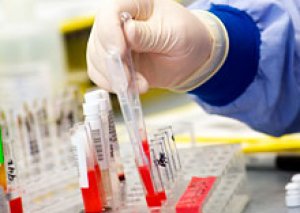 Baş infeksionist “qara yara”ya yoluxmamaq üçün tövsiyələr verdi