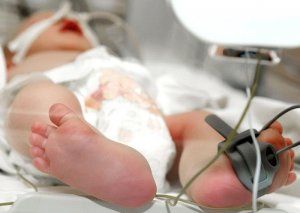 40 günlük körpənin ürək əməliyyatı uğurlu alındı