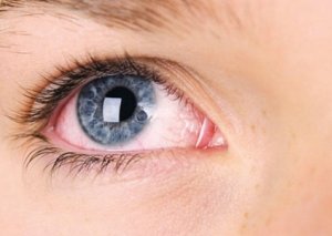 Koronavirusun yeni əlaməti ortaya çıxdı: