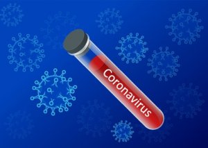 ÜST-dən qorxudan açıqlama: