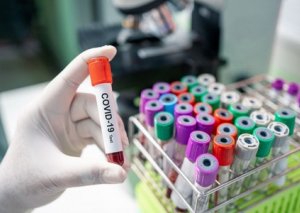 Azərbaycanda koronavirusa daha 230 yoluxma qeydə alınıb,