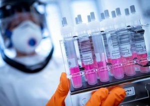 Azərbaycanda daha 647 yeni yoluxma faktı qeydə alınıb