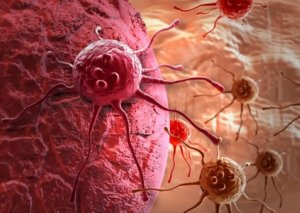 Xərçəng xəstəliyinin yaranması riskini artıran məhsulların adları açıqlanıb