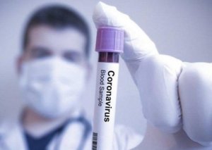 Koronavirusla savaş davam edir -