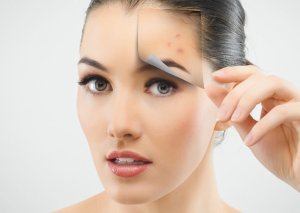 Sızanaqlardan qurtulmağın yolları