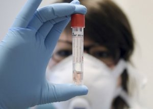 Azərbaycanda koronavirusa 57 yeni yoluxma faktı qeydə alınıb,