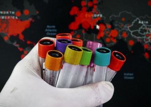 "Koronavirus hələ məşq idi, dəhşətli ssenarilər qabaqdadır"