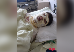 Sumqayıtda yataqxanada partlayış olub, xəsarət alan var -FOTO