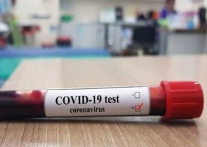 Dünyada koronavirusla bağlı SON STATİSTİKA