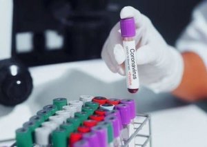 Dünyada koronavirusla bağlı SON STATİSTİKA