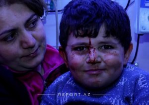 Ermənistanın Gəncədə törətdiyi növbəti terrordan bir il ötür