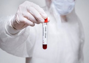 Yoluxanların sayı açıqlandı