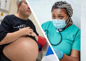 Bu kişi hamilə deyil, sadəcə böyrəkləri 35 kiloqramdır -
