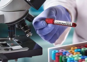 Son sutkada nə qədər adam yoluxub?