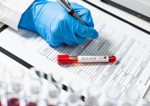 Son sutkada yoluxanların sayı açıqlandı