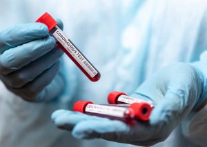 Yoluxanların sayı açıqlandı