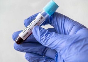 İcbari Tibbi Sığorta Dövlət Agentliyi 5 mln manatlıq koronavirus testi alır