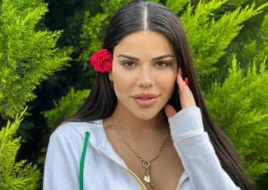 Bədəni çürüyən azərbaycanlı modelin DƏHŞƏTLİ KADRLARI - FOTOLAR