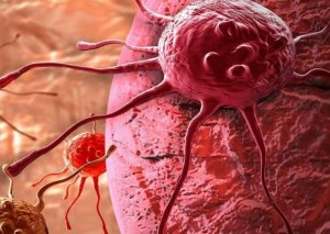 Xərçəng hüceyrələrinə qarşı molekul KƏŞF EDİLDİ