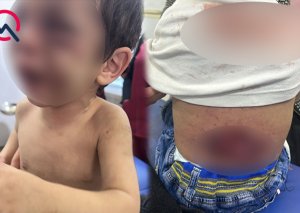 Narkotik basqınına gedən polislər dəhşət yaşadılar - Azərbaycanda ŞOK - FOTO