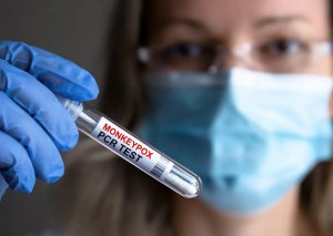 Azərbaycana da gəlib çatdı - Necə qorunaq?