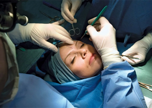 Plastik cərrahların lisenziyalarının ləğvi ilə bağlı - Rəsmi açıqlama