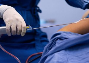 Sumqayıtda liposaksiya etdirən qadın öldü