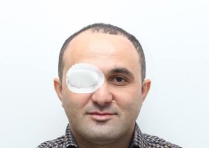 Gənc Qazilər İctimai Birliyinin sədri həbs edilib