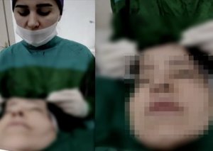 Həkim üzgərmə əməliyyatında canlı yayım açdı - Araşdırma BAŞLADI