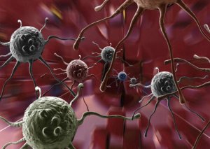 Zərərsiz bildiyimiz vərdişlər xərçəngə aparır - Onkoloqdan xəbərdarlıq