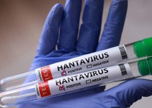Dəhşətli virus SÜRƏTLƏ YAYILIR - Yeni yoluxmalar aşkarlandı