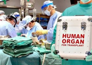 Azərbaycanda transplantasiya əməliyyatları icbari sığortaya salına bilər