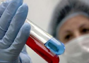 Bakıda gəzən qorxulu virus