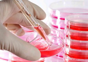 Ölkədə hepatitlə bağlı STATİSTİKA açıqlandı