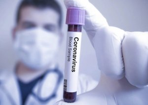 Son sutkada 7 nəfər koronavirusdan öldü - Statistika