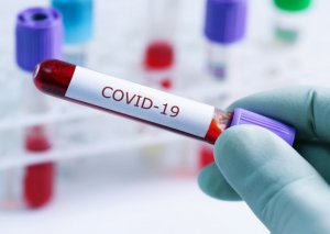 Koronavirusun yeni "Arcturus-XBB.1.16" ştammı yayılmaqdadır