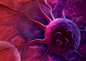 Onkoloq xərçəng hüceyrələrini məhv edə bilən 4 qidanı sadaladı